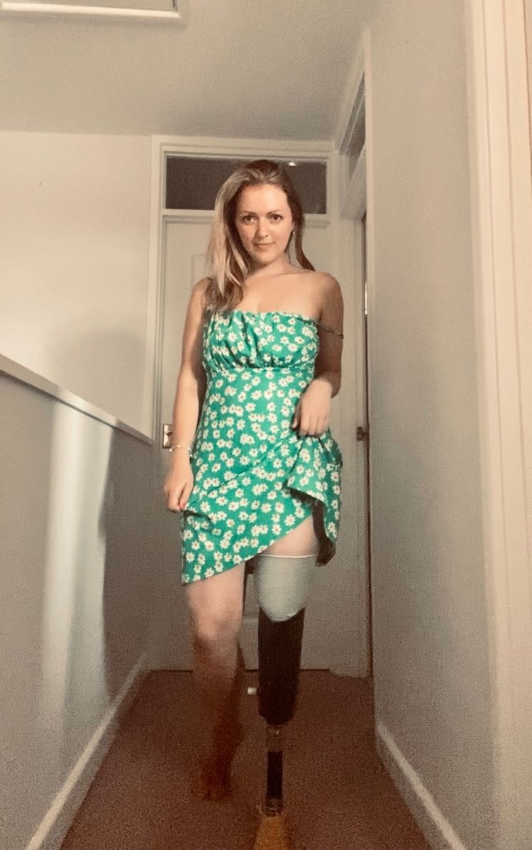 Best Amputee OnlyFans Accounts amputeebee