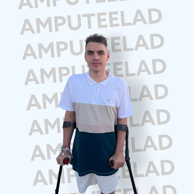 Best Amputee OnlyFans Accounts amputeelad