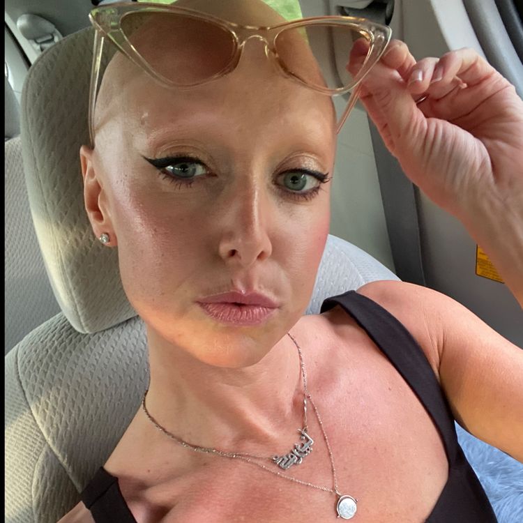 Best Bald OnlyFans Accounts baldbikinibabe